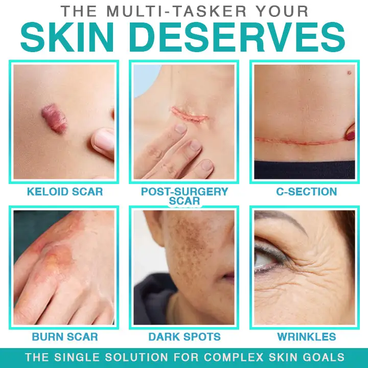 Ošetřující mikrojehličková náplast BBOJI® 3 v 1 - Obrázek 3