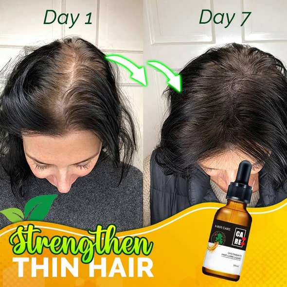 10X-Regro Strong vlasové sérum