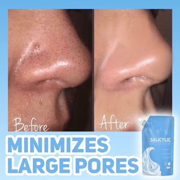 Salicylová hydromaska - Obrázek 3