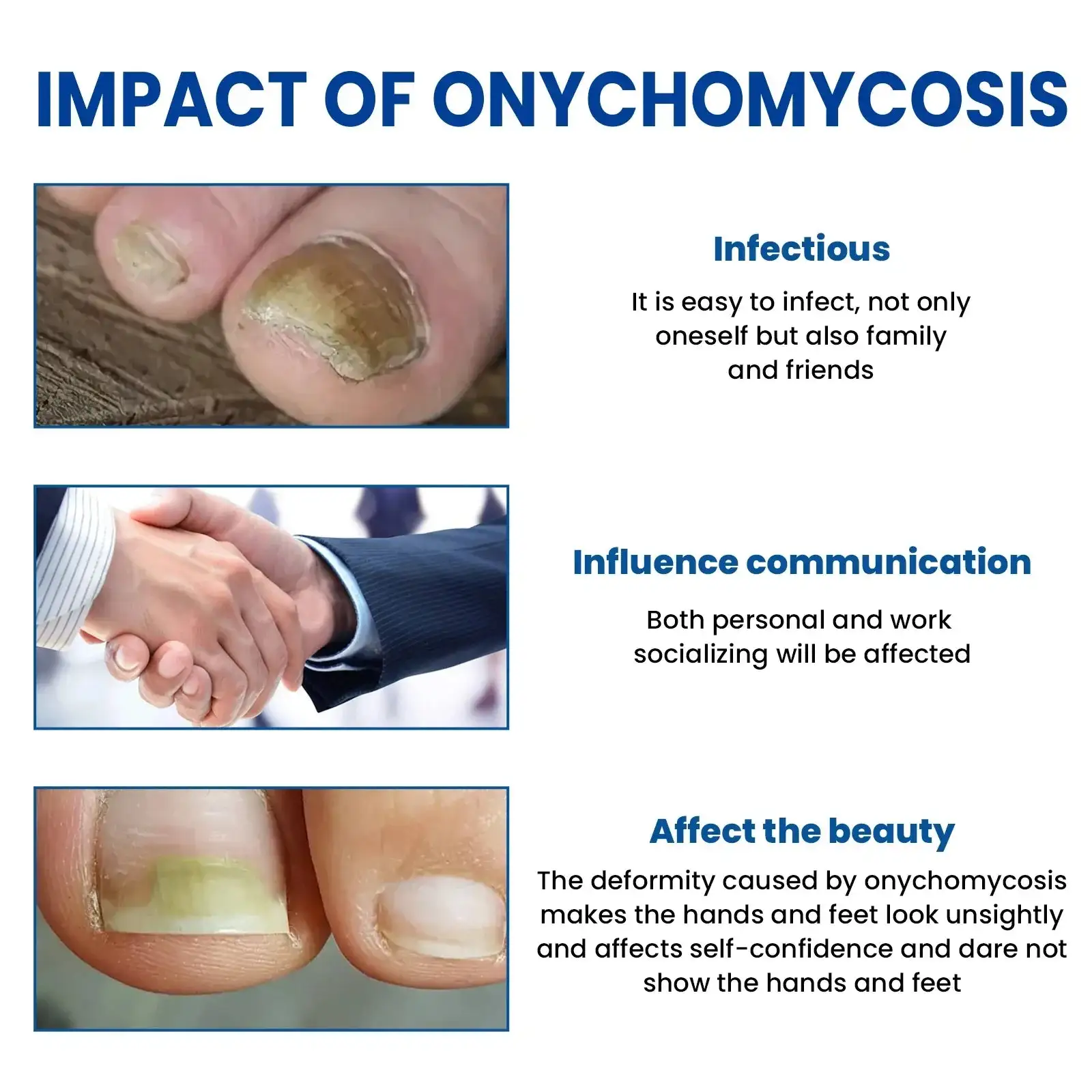 Náplasti na opravu nehtů - Obrázek 2