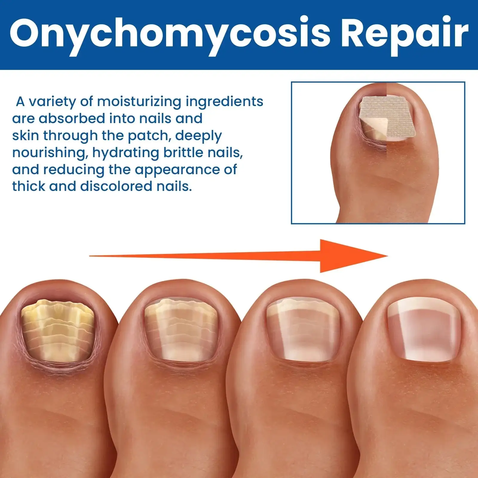 Náplasti na opravu nehtů - Obrázek 4