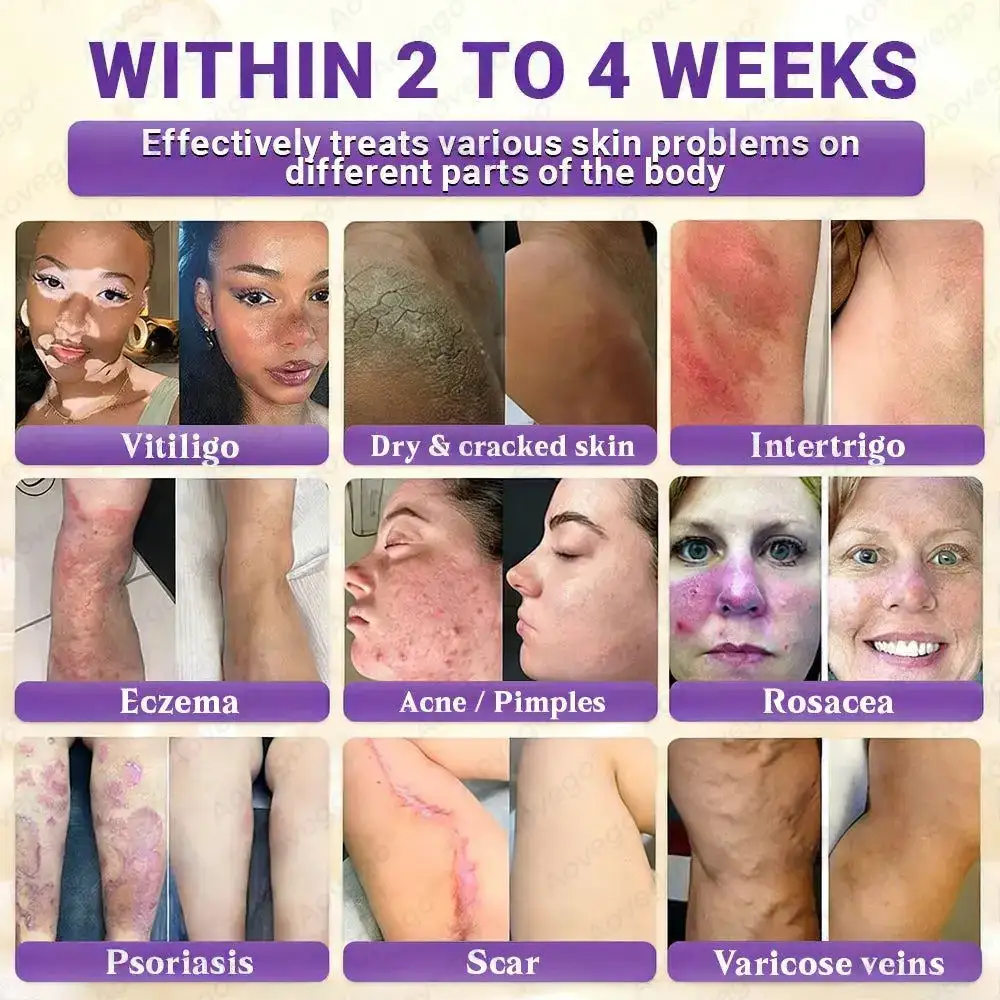 BIOTIN 10-IN-1 Advanced Skin Repair Cream - Obrázek 2