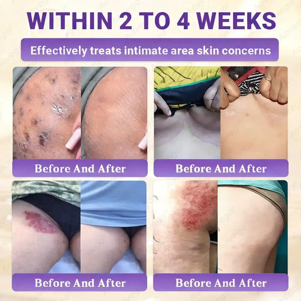 BIOTIN 10-IN-1 Advanced Skin Repair Cream - Obrázek 3