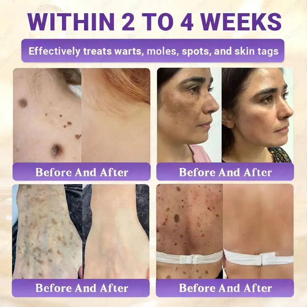 BIOTIN 10-IN-1 Advanced Skin Repair Cream - Obrázek 4