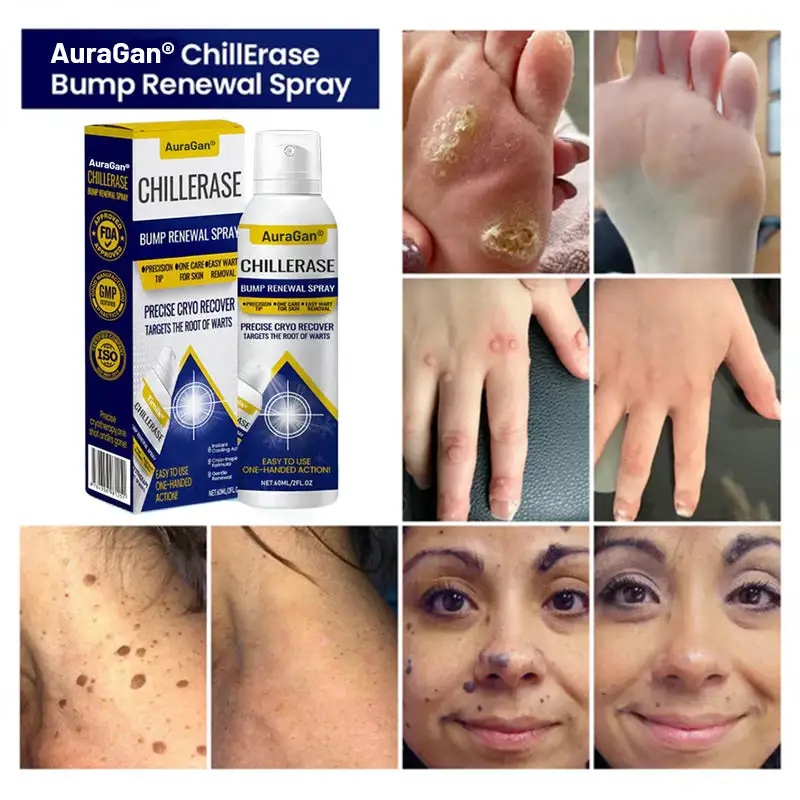 ChillErase Bump Renewal Spray - Obrázek 4