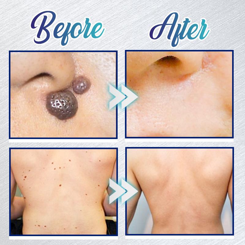 Gel na okamžité odstranění skvrn - Obrázek 3