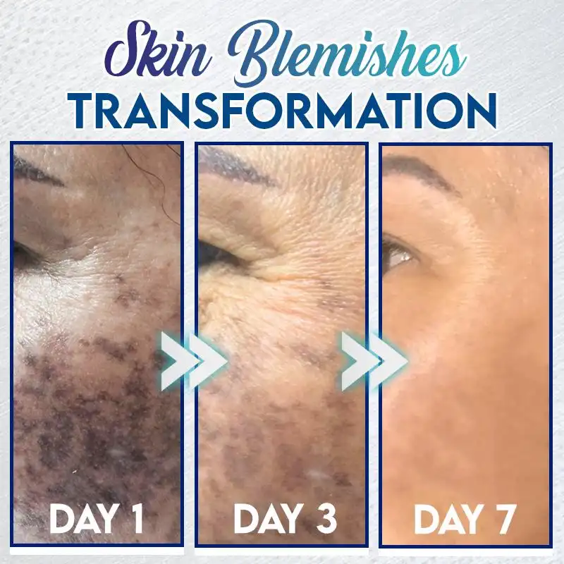 Gel na okamžité odstranění skvrn - Obrázek 2