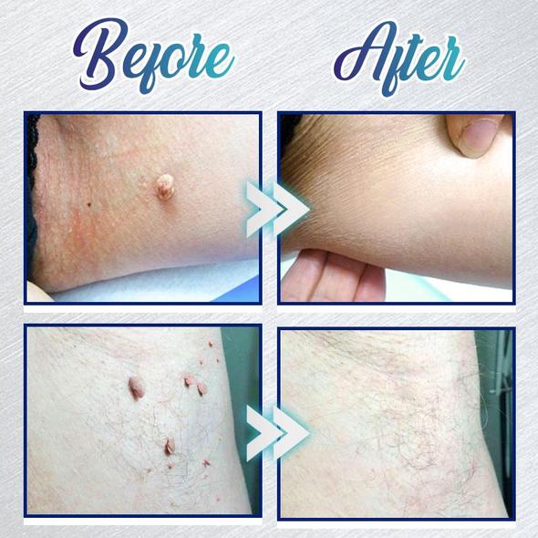 Gel na okamžité odstranění skvrn - Obrázek 4