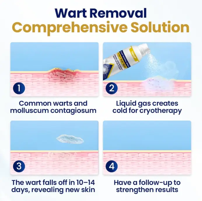 Chillique Bump Renewal Spray - Obrázek 3